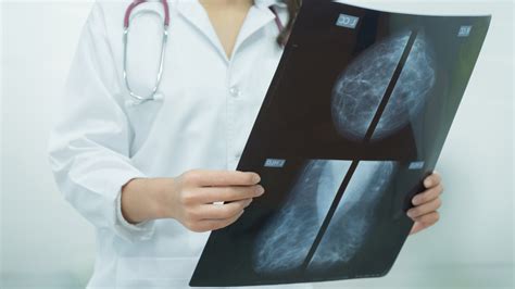 Las mujeres deberían realizarse mamografías desde los 40 años, en lugar de los 50, para detectar cáncer de mama, dice recomendación